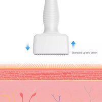 Radiant Skin Microneedling Roller™